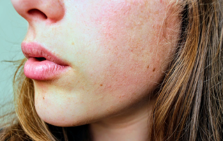 CBD Oil Helps